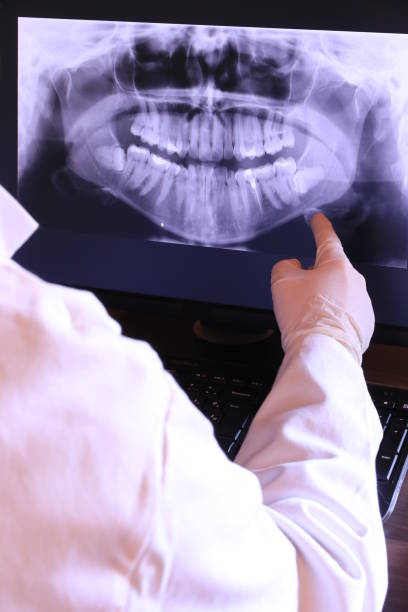 Best Emergency Treatment for Toothache in Montrose, NY